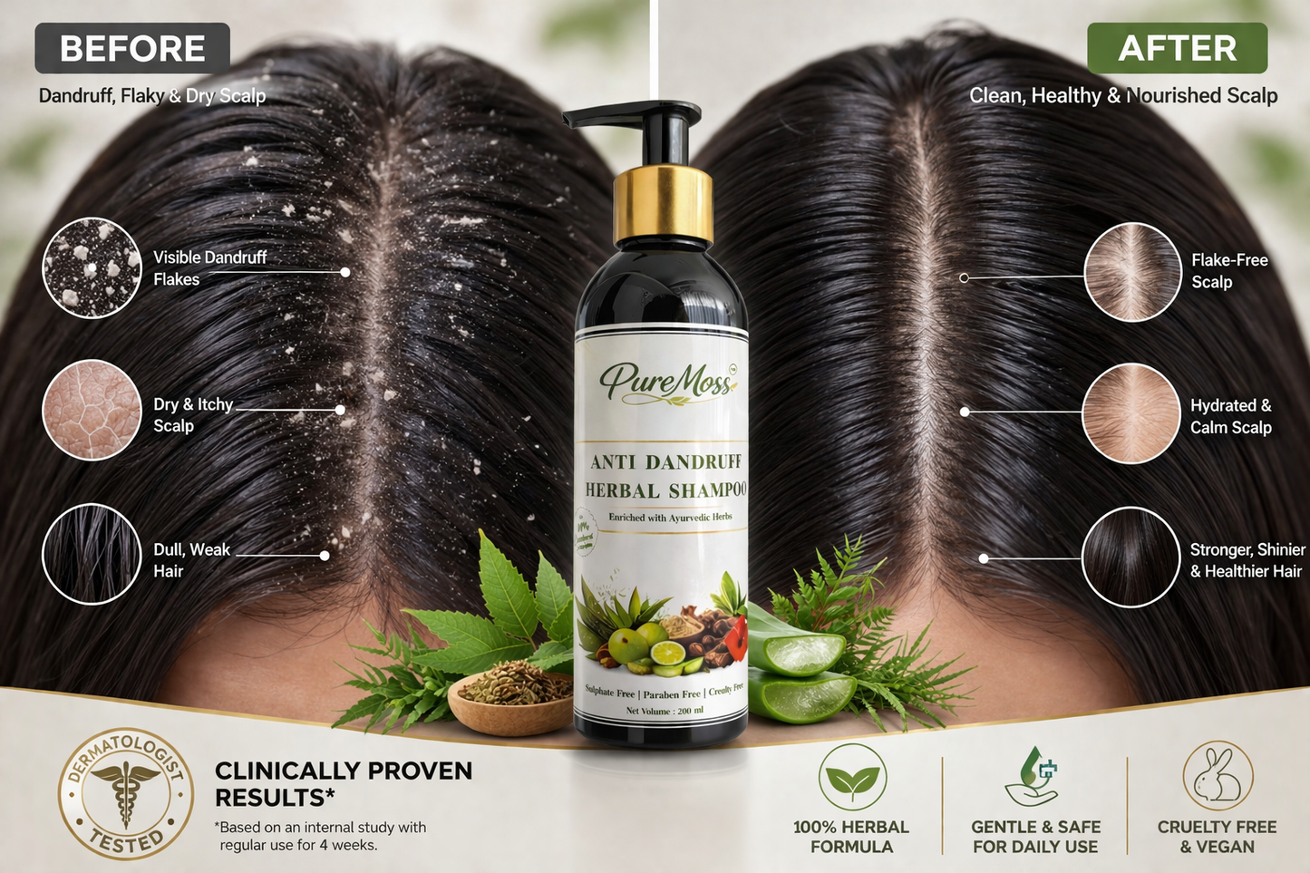 Ayurvedic Anti Dandruff Shampoo for Strong & Fresh Hair