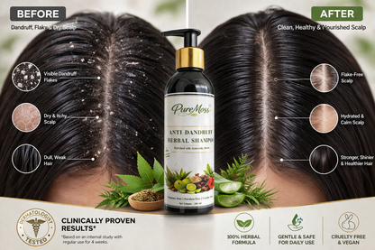 Ayurvedic Anti Dandruff Shampoo for Strong & Fresh Hair